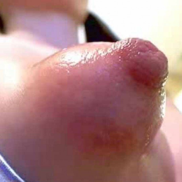 Puffy Nipple Pics